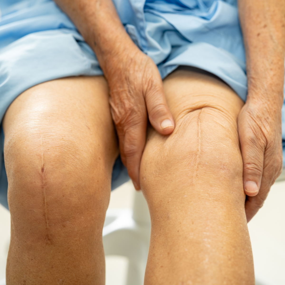 When the Body Hasn’t Finished Healing: A Khi Tam Approach to Knee Replacement Recovery